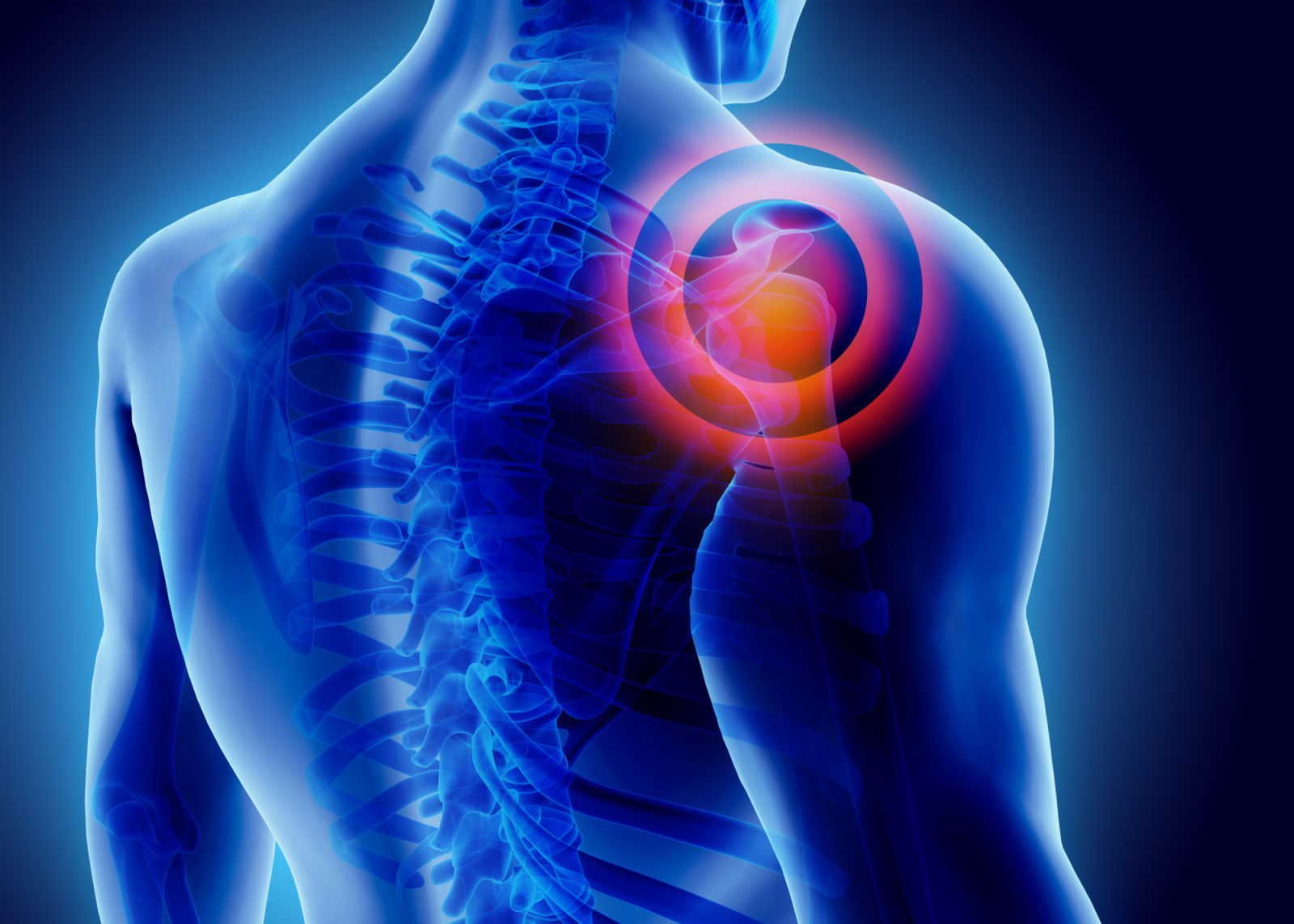Shoulder Pain Relief and TreatmentJoint Pain Relief and